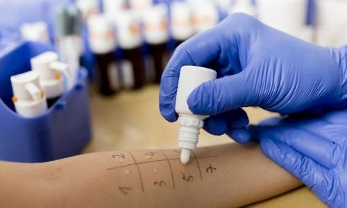 Prueba para detectar alergias